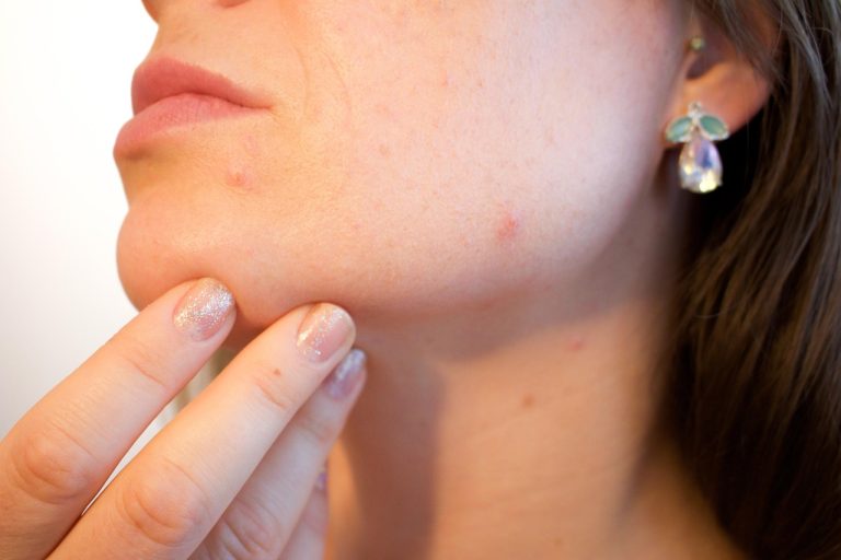 From Consultation to Confidence: How Cheek Dermal Fillers Are Shaping Modern Facial Transformation